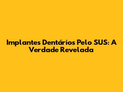 Implantes Dentários Pelo SUS: A Verdade Revelada